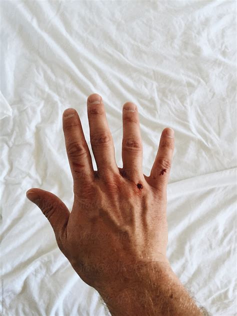 Bloody Knuckles .